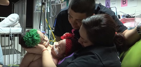 Mom Says Goodbye To Her Conjoined Twins. 24 Hours Later, She Gets Them Back!