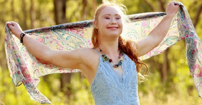 Girl With Down Syndrome Fought All Stereotypes And Became A Model!