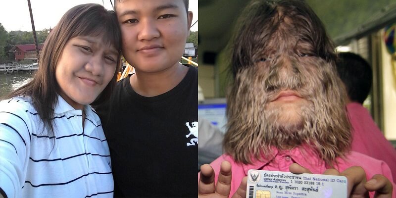 The â€˜Worldâ€™s Hairiest Girlâ€™ Has Shaved Her Face And Is Happily Married